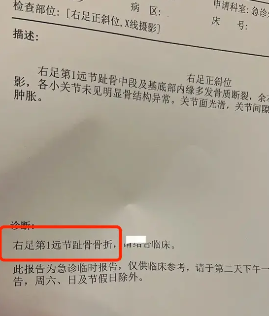 骨折病历图片